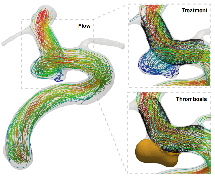 Blood flow simulation – University of Manchester